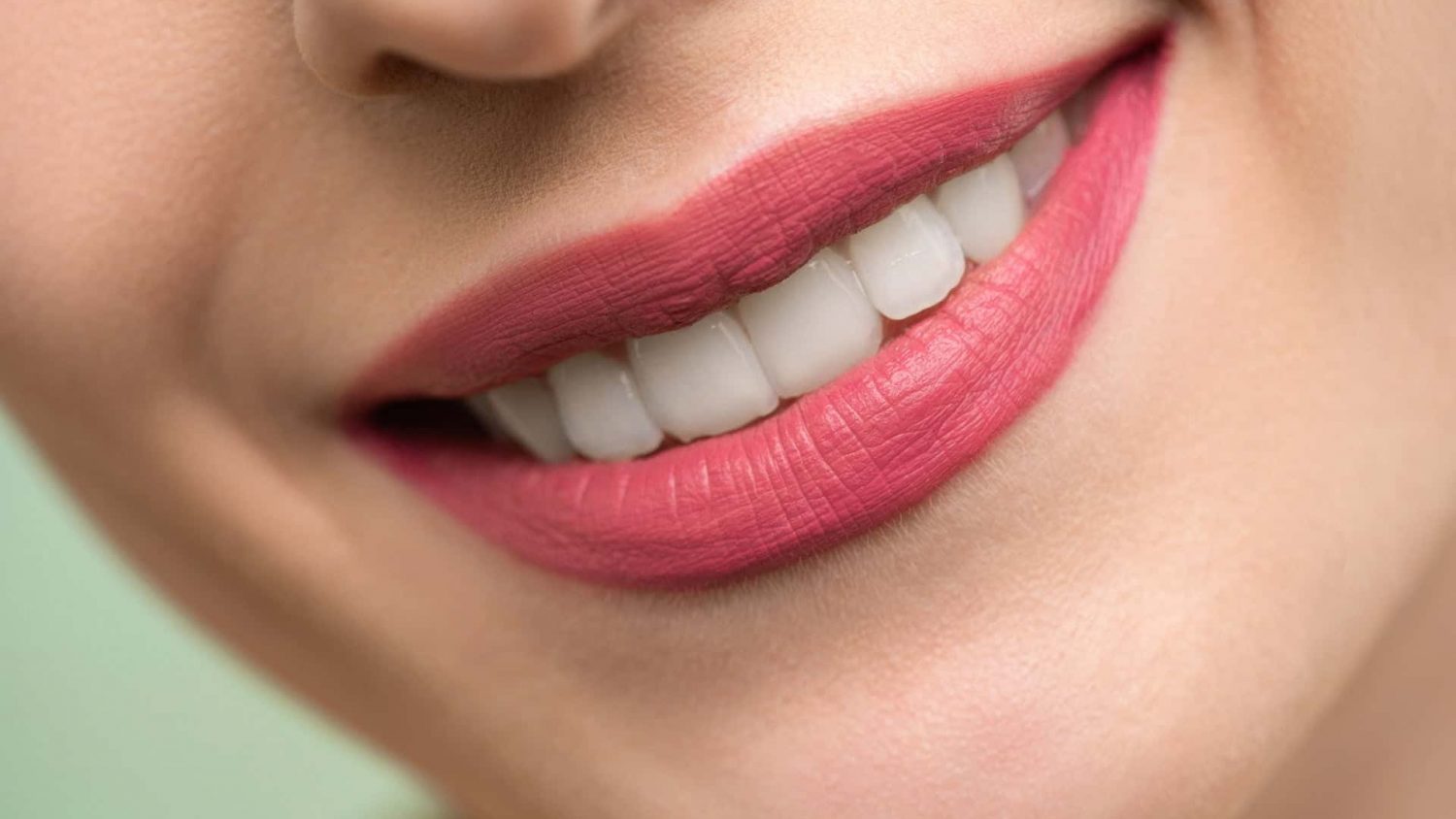 Best Teeth Whitening Kit – 6 Teeth Whitening Kits for a Stunning Smile